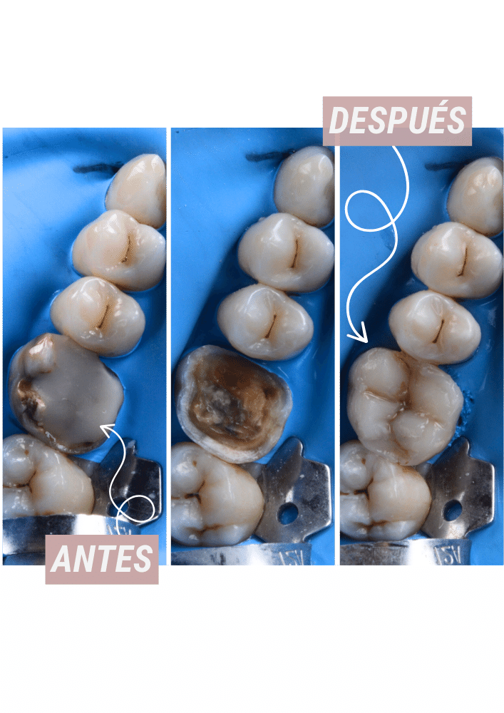 empaste-dental-que-es-planes-mariano