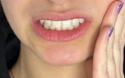 La sensibilidad dental: guía completa para una sonrisa sin dolor